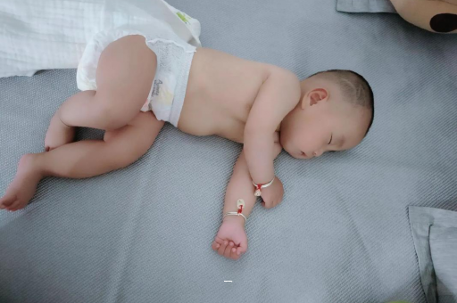 代怀选性别包生男孩宝宝脸上有白色斑块